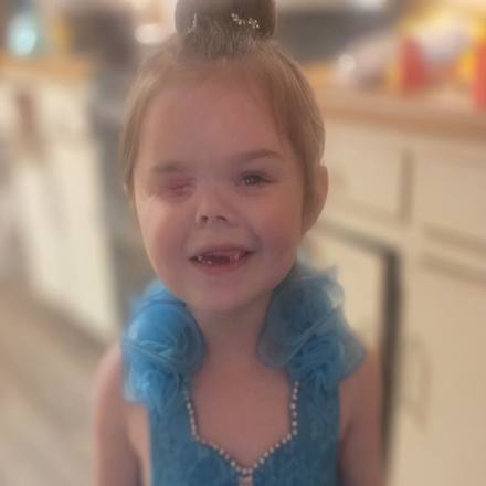 Rally Kid Kylee, Surviving Bilateral Retinoblastoma